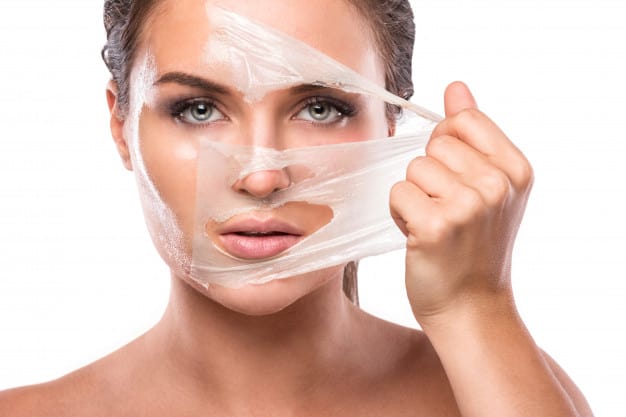 skin peel treatment