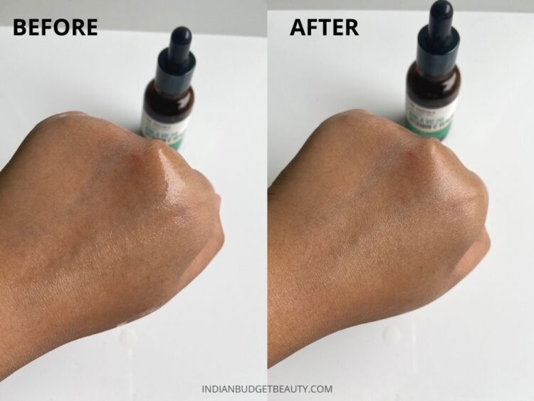 Dr Sheths Amla VC 20 Vitamin C Serum Review | Clinic @ Home